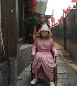 ​中国第一整容狂人，红粉宝宝13年整200多次(险丧命)