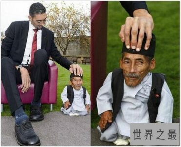 ​世界第一高人是位土耳其小伙 因病获得世界第一的称号