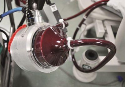 ​ecmo(如何用好ICU里的终极武器：ECMO)