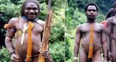 ​权世界上体积最大的男性生殖器，之10个你絕對没听过的人体之最