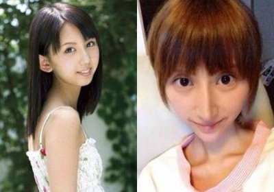 ​日本美少女整容上瘾，因整容过度变锥子脸，看上去像“怪物”！