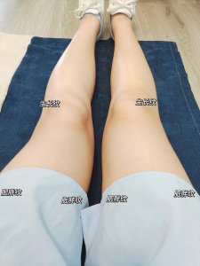 ​四个步骤淡生长纹肥胖纹，下车啦家人们