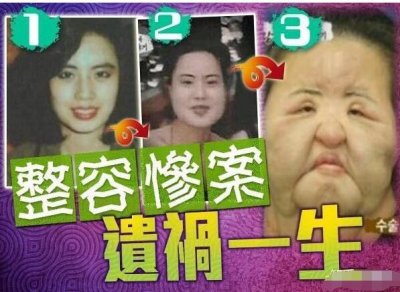​“电风扇阿姨”去世，她曾是光鲜亮丽的模特，为何沉迷整容？