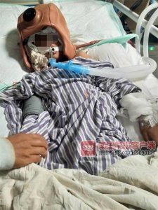 ​短短10多分钟内连喝3杯米酒，博白一10岁男孩酒精中毒陷入昏迷