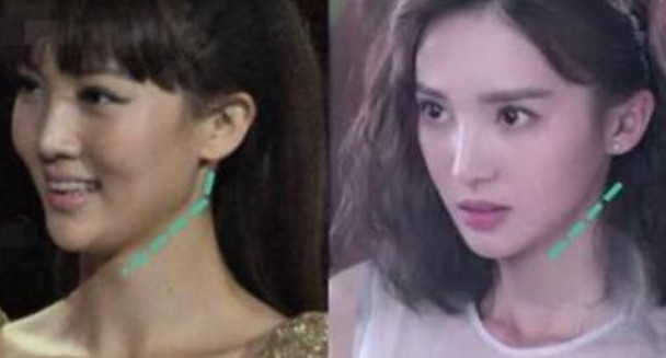 金晨整容太明显了 以前鼻子脸钝感十足现在精致的没槽点