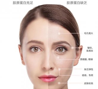 ​胶原蛋白的食物和水果（女性吃什么补胶原蛋白）