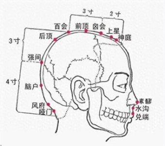 ​神奇强间穴，又称颈僵穴，舒筋活络主治颈部强痛的要穴，值得了解