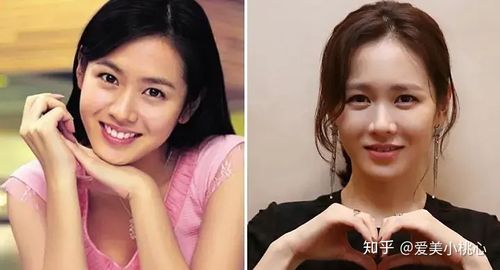 孙艺珍整容前,宋仲基为什么这么恨(宋仲基整过容吗) 孙艺珍整容前,宋仲基为什么这么恨(宋仲基整过容吗)