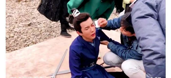 于朦胧眼睛受伤视频曝光被道具戳伤流血不止，忍痛问：我不会瞎吗