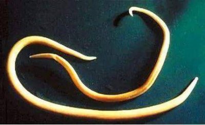 ​神秘的外来入侵者——麦地那龙线虫