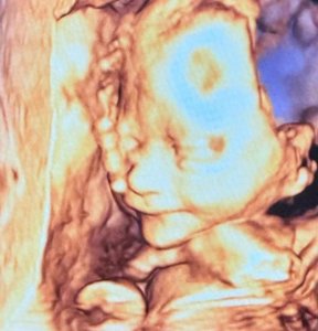 ​包文婧8个月孕肚孕晚期与包贝尔给老二选床，面条子真容被曝光了